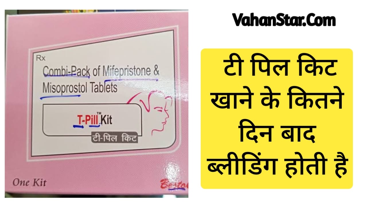 Read more about the article टी पिल किट खाने के कितने दिन बाद ब्लीडिंग होती है T Pil Kit khane ke kitne din bad bleeding hoti hai